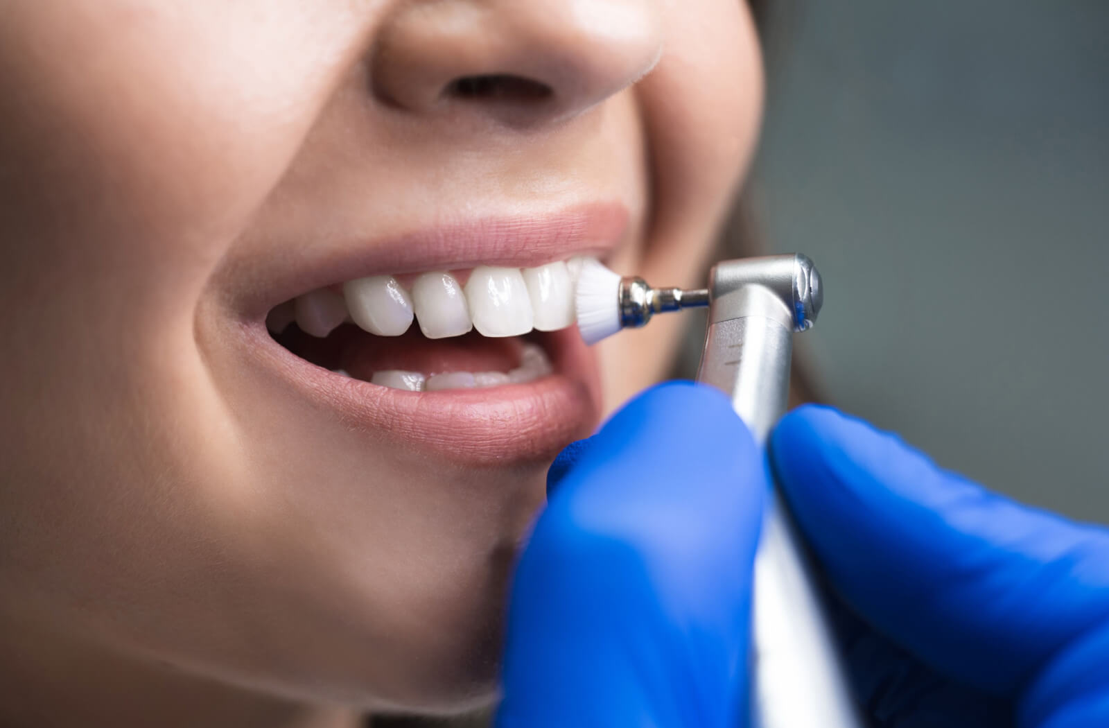 A woman's mouth is open and a hand in a blue glove holding a dental brush is cleaning the patient's teeth.